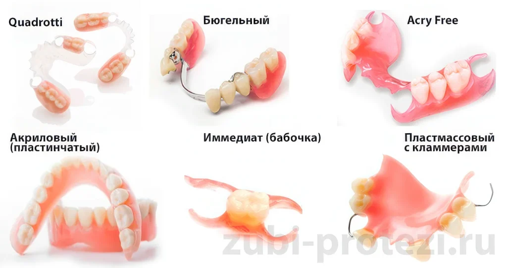 Съемные протезы