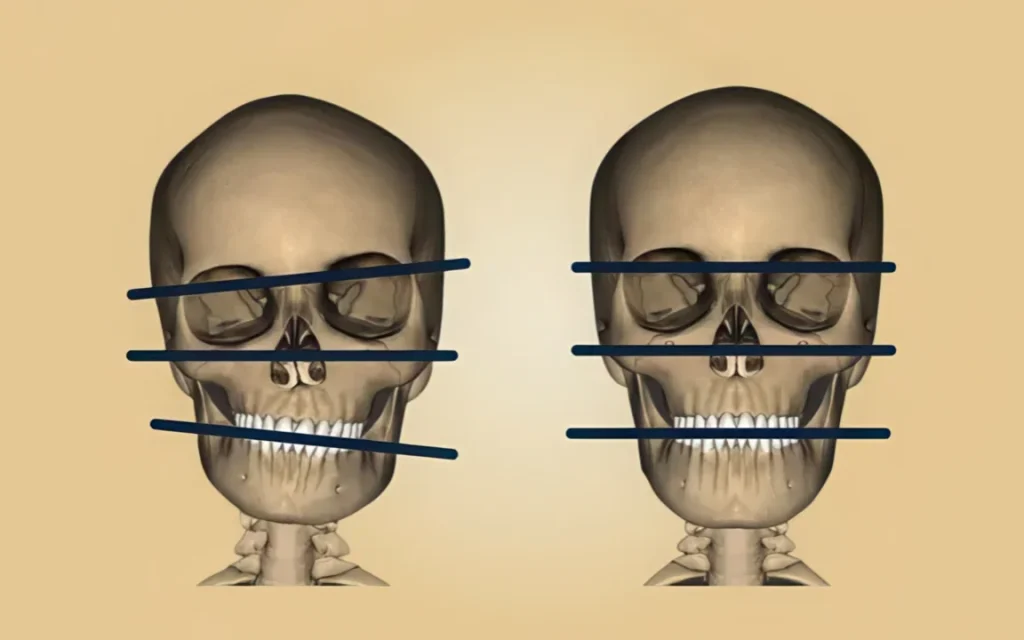 Нарушение прикуса