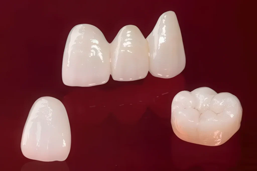 E.max (литиевый дисиликат)