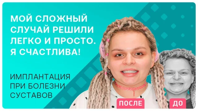 Имплантация при болезни суставов