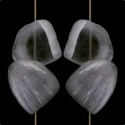 Эстетическая облицовка