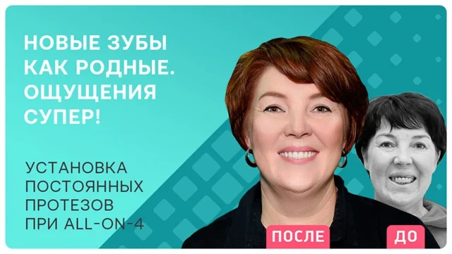 Все этапы лечения All-on-4