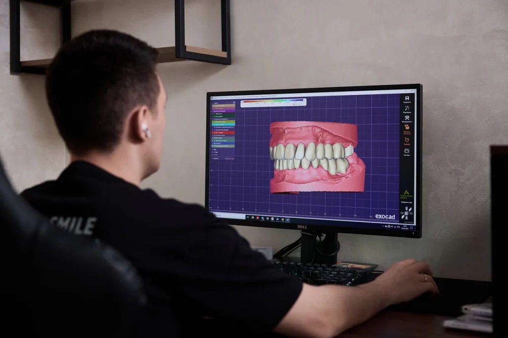 виртуальное моделирование зубных рядов в Exocad
