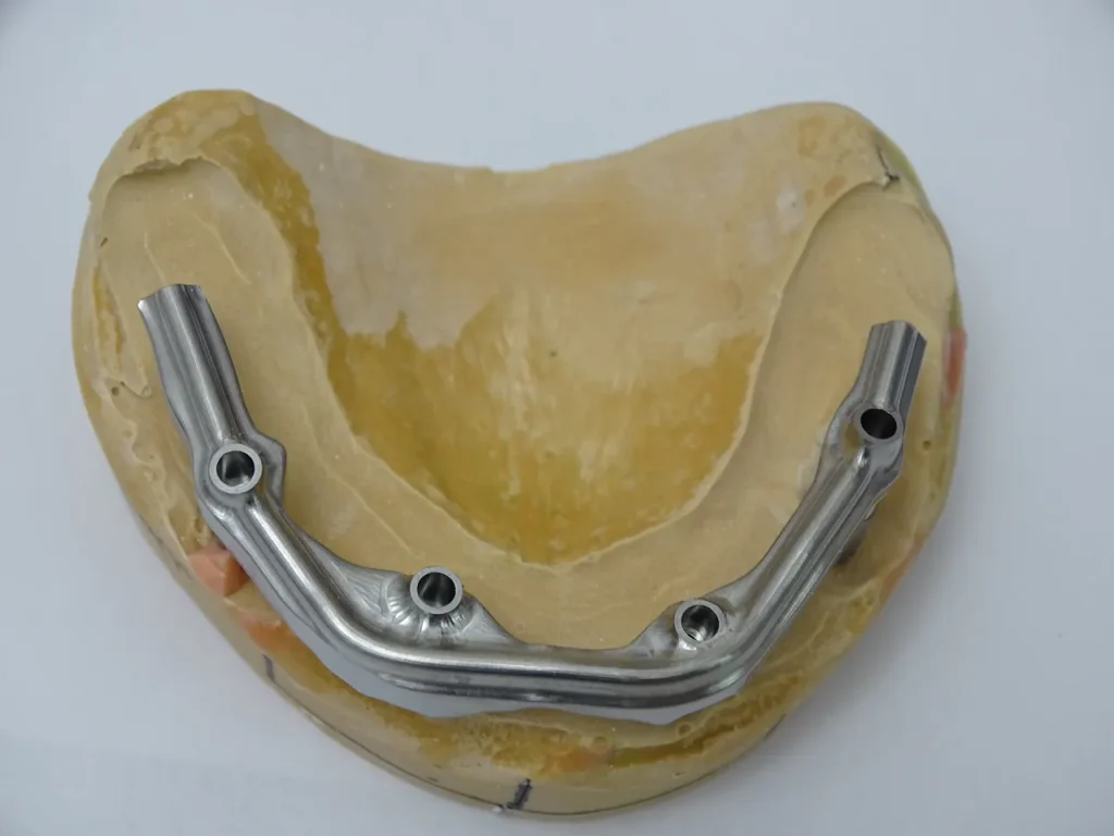 Демонстрационная или рабочая модель металлической балки (каркаса) для протеза на имплантах
