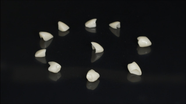 Керамокомпозитные коронки: современные материалы