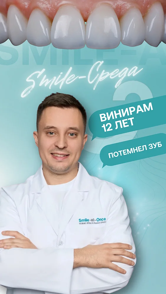 Ответы о винирах — в коротком и понятном видео