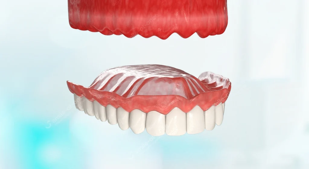 Протезы Acry-Free: комфорт и лёгкость, которые чувствуются с первого дня