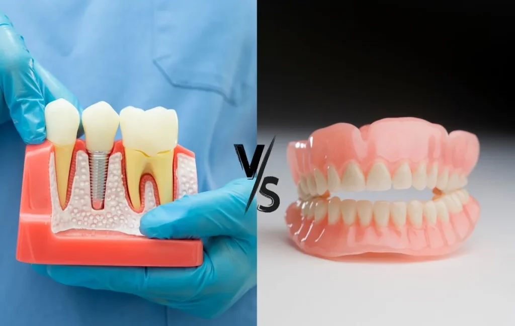 Съёмные протезы и несъёмные: что лучше?
